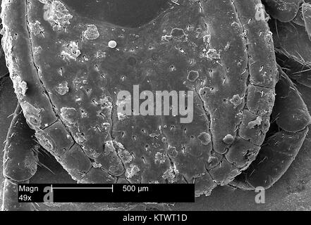 Diese Scanning Electron Micrograph (SEM) zeigt eine dorsalansicht der harten scutum eines American dog Tick, Dermacentor variabilis vergrößert 49 X. Zecken sind der Klasse Spinnen, Spinnen und Milben, 2002. D. variabilis ist ein bekannter Anbieter von Rocky Mountain Spotted Fever, verursacht durch das Bakterium Rickettsien rickettsii. Mit freundlicher CDC. Stockfoto