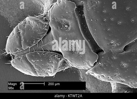 Diese Scanning Electron Micrograph (SEM) Zeigt die dorsale Ansicht der Leiter Region aus einem American dog Tick, Dermacentor variabilis, vergrößerte 98 X. Zecken sind der Klasse Spinnen, Spinnen und Milben, 2002. D. variabilis ist ein bekannter Anbieter von Rocky Mountain Spotted Fever, verursacht durch das Bakterium Rickettsien rickettsii. Mit freundlicher CDC. Stockfoto