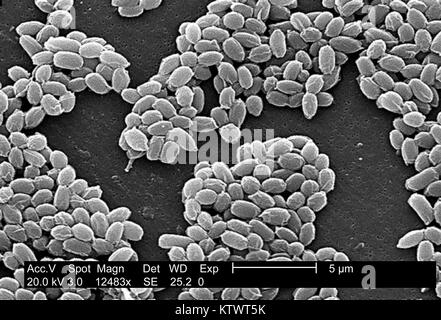 Unter einer hohen Vergrößerung von 12, 483 X, das Scanning Electron Micrograph (SEM) dargestellt Sporen von die Sterne Stamm von Bacillus anthracis Bakterien. Für eine schwarz-weiß Version dieses Bildes siehe PHIL10122. Ein wesentliches Merkmal des Sterne Belastung von B. anthracis ist die zerknitterten Oberfläche des Proteins Mantel dieser bakteriellen Sporen. Diese Sporen können für viele Jahre, können die Bakterien in einem schlafenden Zustand zu überleben Leben. Mit freundlicher CDC/Laura Rose, 2002. Stockfoto