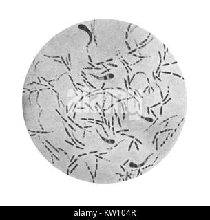 In dieser Abbildung wird eine photomicrographic Ansicht von Corynebacterium diphtheriae- Bakterien mit einem Gram-Fleck-Technik. Corynebacterium diphtheriae- ursachen Diphtherie-, dass die oberen Atemwege, wo eine entzündliche Exsudat verursacht schwere Behinderung der Atmung Atemwege betrifft, und in manchen Fällen auch Ersticken verursachen kann. Mit freundlicher Genehmigung der CDC, 1979. Stockfoto