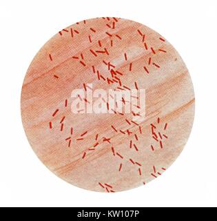 Eine photomicrograph Escherichia-coli-Bakterien mit Gram-Fleck-Technik. E. coli O157:H7 ist eines von Hunderten von Belastungen des Bakteriums Escherichia coli, die schwere blutige Durchfälle und Bauchschmerzen Krämpfe verursachen kann, und in einigen Fällen sogar zum Tod führen. Mit freundlicher Genehmigung der CDC, 1979.