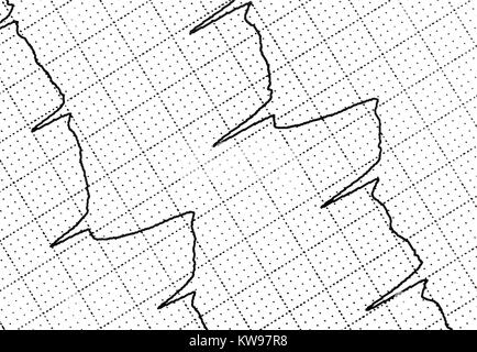 Ekg-Test zeigt, dass die elektrische Aktivität des Herzens Stockfoto