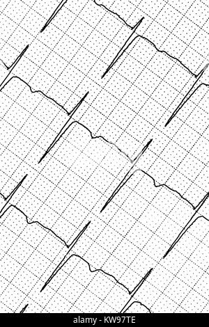 Ekg-Test zeigt, dass die elektrische Aktivität des Herzens Stockfoto