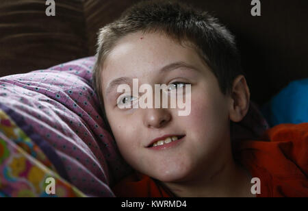 Davenport, Iowa, USA. 12. Januar 2017. Ryan McDermott, 10, lächelt und schaut aus dem Fenster auf die McDermott zu Hause in Davenport auf Donnerstag, 12. Januar 2017. McDermott war als Kleinkind mit Dravet-Syndrom, einer schweren Form von Epilepsie diagnostiziert und hat derzeit zwischen 10 und 20 Anfälle pro Tag. Eine Cannabis-Öl-Studie durch die Universität von Iowa funktionierte nicht für McDermott, aber er wird in Kürze eine Studie durch die Mayo-Klinik namens Fenfluramin Bewertung bei seltenen Epilepsie beginnen. Bildnachweis: Andy Abeyta/Quad-Stadt-Zeiten / ZUMA Draht/Alamy Live News Stockfoto