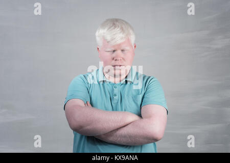 Albino junger Mann portrait. Blonde Kerl mit grauem Hintergrund isoliert. Albinismus Stockfoto