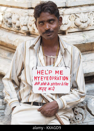 Blinder Mann für ein Auge Chirurgie, Udaipur, Rajasthan, betteln, Indien Stockfoto