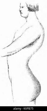 Eine Seite aus dem Korsettenkatalog von Rainal Frères, Abb. 139 mit strukturellen Details, dekorativen Elementen und Unterwäsche-Stilen aus dem frühen 20. Jahrhundert. Stockfoto