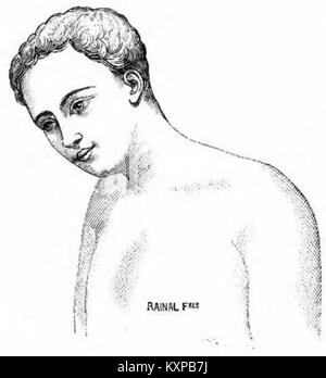 Katalogseite von Rainal Frères mit Korsetts, die französische Mode- und Handwerkstrends des späten 19. Und frühen 20. Jahrhunderts hervorheben. Stockfoto