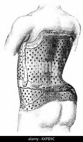 Eine Katalogseite von Rainal Frères, die das Korsettendesign Abb. 1854 zeigt und Details zu Mode, Struktur und dekorativen Elementen enthält. Stockfoto