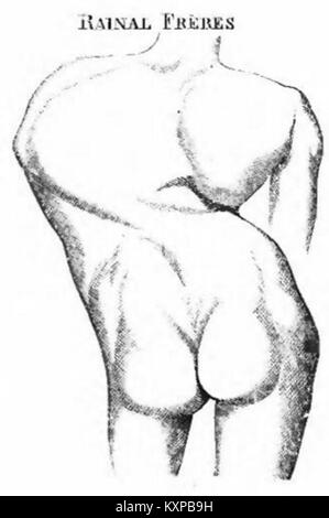 Eine Seite aus dem Korsettenkatalog von Rainal Frères zeigt Abbildung 142, die detailliertes Korsett-Design, Materialien, Struktur und Modetrends des 19. Jahrhunderts veranschaulicht. Stockfoto