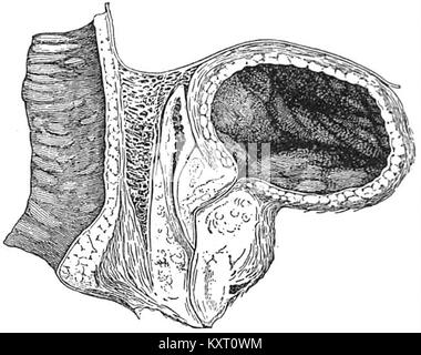 EB 1911 reproduktives System, in der Anatomie der Blase, der Prostata und des Enddarms Stockfoto