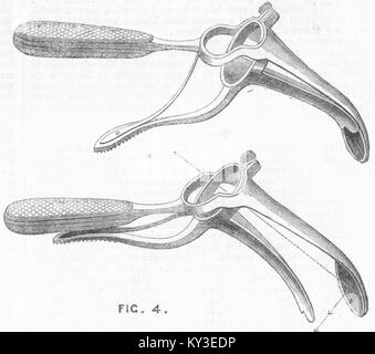 Chirurgie Instrumente Speculum zu Kehlkopf 1867 erhalten. Illustrated London News Stockfoto