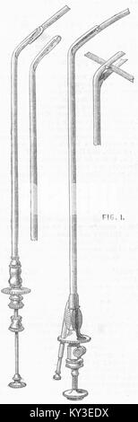 Chirurgie D'etiolle Instrument, Blase Extraktion 1867. Illustrated London News Stockfoto