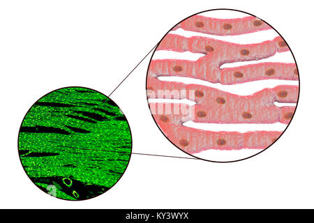 Herzmuskel Struktur, Computer Bild und Licht schliffbild. Herzmuskel besteht aus Spindelförmige Zellen in unregelmäßigen Bundles zusammengefasst. Grenzen zwischen den einzelnen Zellen sind schwach sichtbar. Jede Zelle enthält einen Kern, sichtbar als dunkle Flecken. Herzmuskel ist eine spezialisierte Muskelgewebe, die regelmäßig und kontinuierlich ohne ermüdenden Vertrag kann. Stockfoto