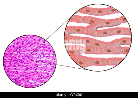 Herzmuskel Struktur, Computer Bild und Licht schliffbild. Herzmuskel besteht aus Spindelförmige Zellen in unregelmäßigen Bundles zusammengefasst. Grenzen zwischen den einzelnen Zellen sind schwach sichtbar. Jede Zelle enthält einen Kern, sichtbar als dunkle Flecken. Herzmuskel ist eine spezialisierte Muskelgewebe, die regelmäßig und kontinuierlich ohne ermüdenden Vertrag kann. Stockfoto