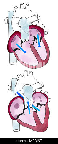 Herz, Ventrikel, der menschlichen Anatomie, kardiale Ventrikel. Menschliche Körper, Abschnitt Stockfoto