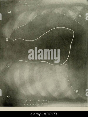 "Röntgen strahlen und Elektro-Therapeutics: mit Kapiteln über Radium- und Phototherapie' (1910) Stockfoto