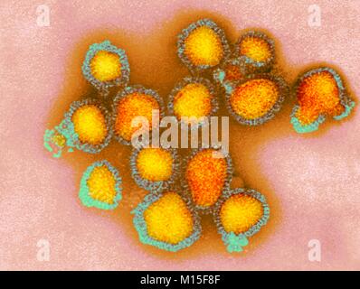 H3N2 Influenza Virus Partikel, farbige Transmission Electron Micrograph (TEM). Jedes Virus besteht aus einem nucleocapsid Protein (Mantel), umgibt einen Kern der RNA (Ribonukleinsäure) genetischen Material. In der Umgebung des Nukleokapsid- ist ein Lipid Umschlag, enthält das glykoprotein spikes Hämagglutinin (H) und Neuraminidase (N). Diese Viren waren Teil der Hongkong Grippe Pandemie von 1968/69 getötet, dass etwa eine Million weltweit. H3N2-Viren sind in der Lage, Vögel und Säugetiere sowie Menschen anstecken. Stockfoto