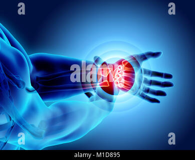 Handgelenk schmerzhaft - Skelett Röntgen, 3D Illustration medizinisches Konzept. Stockfoto