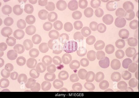 Plasmodium vivax microgametocyte im Blutausstrich, photomicrograph, 1977 aufgedeckt. Mit freundlicher Seuchenkontrollzentren (CDC)/Dr Mae Melvin. () Stockfoto