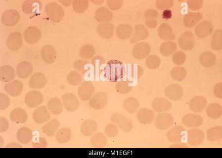 Plasmodium vivax macrogametocyte in einem blutausstrich, photomicrograph, 1973 aufgedeckt. Mit freundlicher Seuchenkontrollzentren (CDC)/Dr Mae Melvin. () Stockfoto