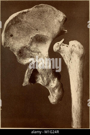 Eine praktische Abhandlung über Brüche und Verwerfungen (1912) (14804773183) Stockfoto