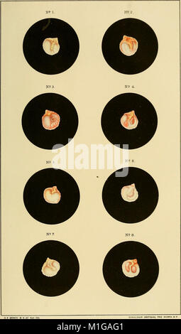 Eine praktische Abhandlung über die Krankheiten des Ohres einschließlich der Anatomie der Orgel (1880) (14781054142) Stockfoto