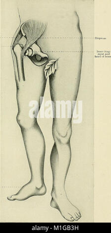 Ein text-Buch der klinischen Anatomie - für Studenten und Praktiker (1907) (14780295662) Stockfoto