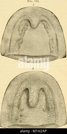 Ein text-Buch über Erkrankungen der Hals-, Nasen- und Ohren (1901) (14593282630) Stockfoto