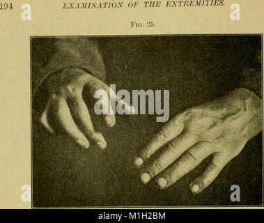 Eine praktische Abhandlung über medizinische Diagnose für Studierende und Ärzte (1904) (14754642034) Stockfoto