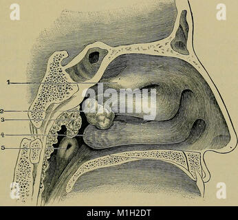 Eine praktische Abhandlung über medizinische Diagnose für Studierende und Ärzte (1904) (14571900957) Stockfoto