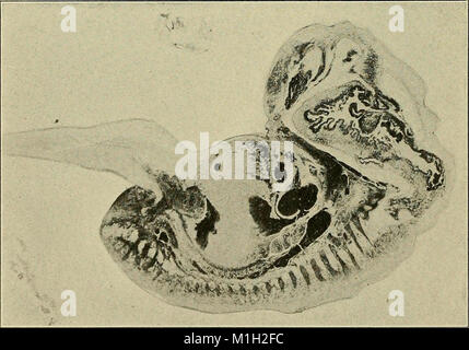 Eine Studie über die Ursachen der Ursprung des menschlichen Monster - dritter Beitrag zu der Studie über die Pathologie des menschlichen Embryonen (1908) (14587228659) Stockfoto