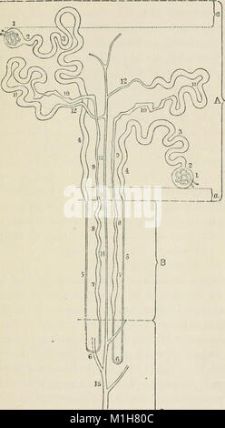 Eine Abhandlung über die hellen Krankheit und Diabetes, mit besonderer Bezugnahme auf die Pathologie und Therapie. Einen Abschnitt über Retinitis in der hellen Krankheit (1881) (14782465272) Stockfoto