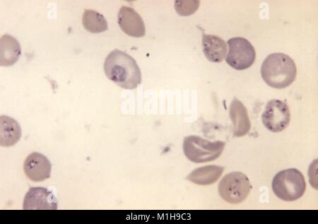 Babesia microti und Plasmodium berghei in den roten Blutkörperchen mit Giemsa zeigte gebeizt, 1972. Mit freundlicher Seuchenkontrollzentren (CDC)/Dr George Healy. () Stockfoto