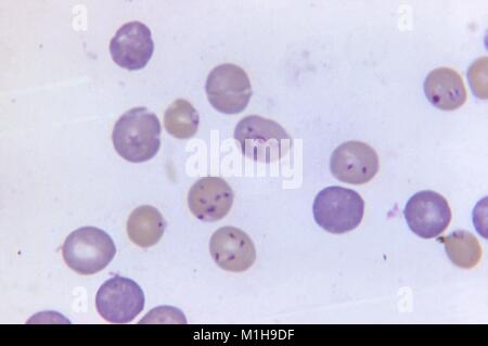 Babesia microti und Plasmodium berghei in den roten Blutkörperchen mit Giemsa zeigte gebeizt, 1972. Mit freundlicher Seuchenkontrollzentren (CDC)/Dr George Healy. () Stockfoto