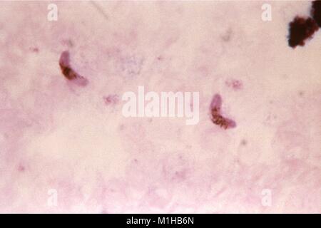 Plasmodium falciparum gametocytes in der Dickschichttechnik schliffbild Blutausstrich, 1966 gefunden. Mit freundlicher Seuchenkontrollzentren (CDC)/Dr. Mae Melvin. () Stockfoto