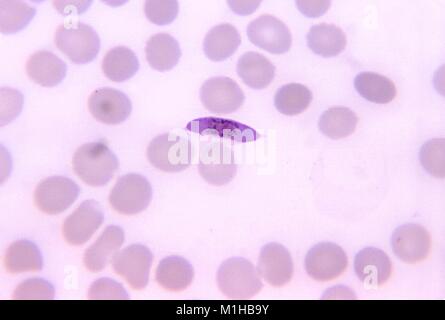 Dünnen Blutausstrich Bild von P. falciparum macrogametocyte, Nierenversagen, 1971 verursachen kann. Bild mit freundlicher Genehmigung von CDC/Dr. Mae Melvin. () Stockfoto