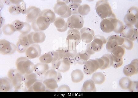 Plasmodium falciparum Ringe in einem blutausstrich Schliffbild, 1967 gefunden. Mit freundlicher Seuchenkontrollzentren (CDC)/Dr. Greene. () Stockfoto
