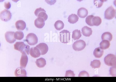 Plasmodium vivax in einem blutausstrich, schliffbild Film, 1972. Mit freundlicher Seuchenkontrollzentren (CDC)/Dr Mae Melvin. () Stockfoto