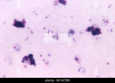 Photomicrograph einer Malaria Parasiten verursacht, Plasmodium vivax, in unreifen Formen schizont, Ringe und wachsenden Trophozoiten, in einer Giemsa gefärbten Blutausstrich, vergrößerte 1125 x, 1971. Bild mit freundlicher Genehmigung von CDC/Dr. Mae Melvin. () Stockfoto