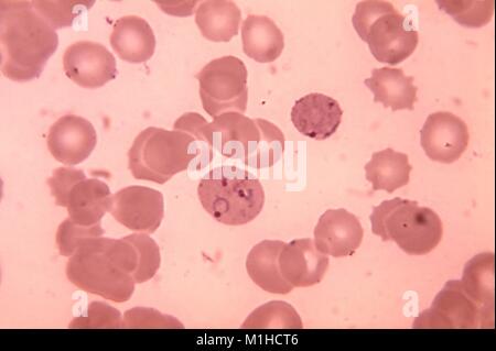 Photomicrograph einer Blutprobe mit der Malaria verursachen Parasiten Plasmodium vivax, in seinen Ring Phase, 1972. Bild mit freundlicher Genehmigung von CDC/Dr. Mae Melvin. () Stockfoto