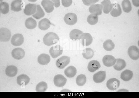 Photomicrograph des Parasiten Plasmodium Vivax Malaria verursacht, die in einem Ring und wachsende ameboid trophozite Formen, auf einen dünnen Film Blutausstrich, 1965. Bild mit freundlicher Genehmigung von CDC/Dr. Mae Melvin. () Stockfoto