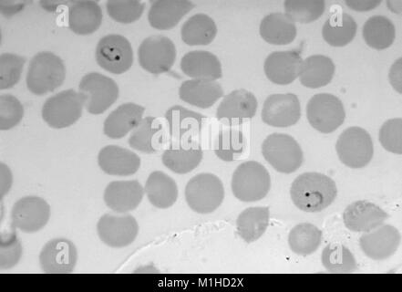 Photomicrograph des Malariaparasiten Plasmodium vivax im Ring Form mit 2 Chromatin dots, auf Thin Film, vergrößerte 1125 x, 1965. Bild mit freundlicher Genehmigung von CDC/Dr. Mae Melvin. () Stockfoto