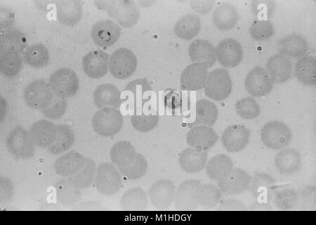 Photomicrograph eines unreifen Plasmodium falciparum schizont und einen Ring bilden, Teile der Parasit, der Malaria, 1963 verursacht. Mit freundlicher CDC/N. J. Wheeler, Jr. () Stockfoto