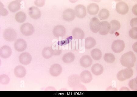 Photomicrograph ein blutausstrich mit einem macrogametocyte von Plasmodium falciparum, der Erreger durch die Anopheles-mücke verschlucken, verursacht Malaria, 1966. Bild mit freundlicher Genehmigung von CDC/Dr. Mae Melvin. () Stockfoto