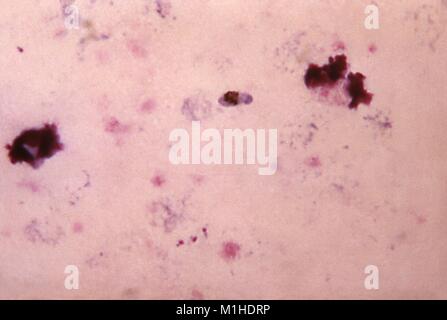 Gametocytes von P. falciparum in einer dicken Blutausstrich, 1966. Bild mit freundlicher Genehmigung von CDC/Dr. Mae Melvin. () Stockfoto