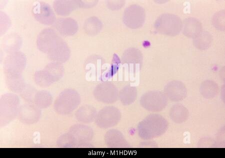 Photomicrograph ein blutausstrich mit einem macrogametocyte von Plasmodium falciparum, der Erreger durch die Anopheles-mücke verschlucken, verursacht Malaria, 1966. Bild mit freundlicher Genehmigung von CDC/Dr. Mae Melvin. () Stockfoto