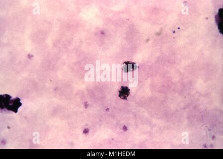 Photomicrograph der Malariaparasiten Plasmodium malariae in schizont Phase, auf einem dicken Blutausstrich, 1964. Bild mit freundlicher Genehmigung von CDC/Dr. Mae Melvin. () Stockfoto