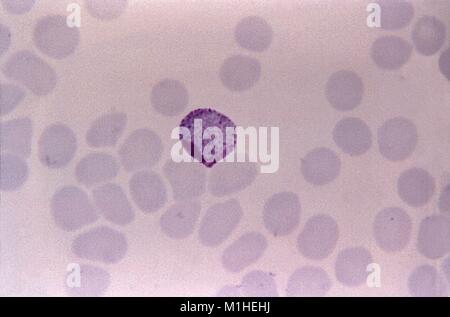 Photomicrograph des Malariaparasiten Plasmodium vivax in Form macrogametocyte (weiblich Gamete) mit ausgeprägten Scufner's Punkte, auf einen dünnen Blutausstrich vergrößerte 1125 x, 1966. Bild mit freundlicher Genehmigung von CDC/Dr. Mae Melvin. () Stockfoto