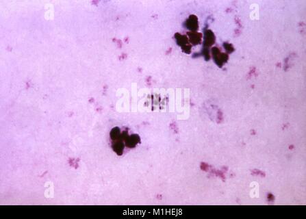 Photomicrograph des Malariaparasiten Plasmodium malariae in seiner reifen Phase schizont, 1965. Bild mit freundlicher Genehmigung von CDC/Dr. Mae Melvin. () Stockfoto